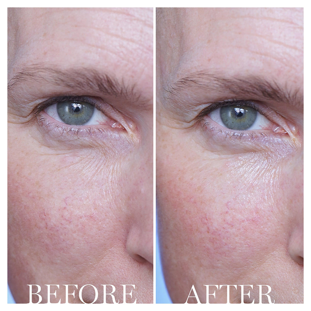 Lancome - Advanced Genifique Eye Cream 15ml - Ascent Luxury Cosmetics