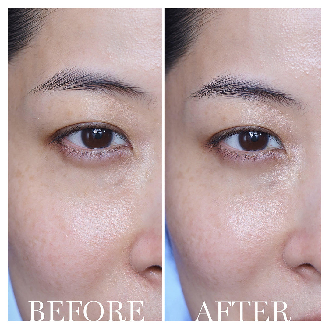 Lancome - Advanced Genifique Eye Cream 15ml - Ascent Luxury Cosmetics